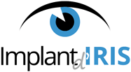 Changer la couleur des yeux - Implant Iris